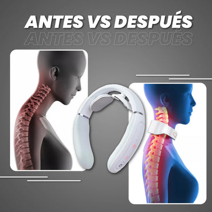 Masajeador Cervical con Calor Terapéutico y Estimulación Suave (Oferta)