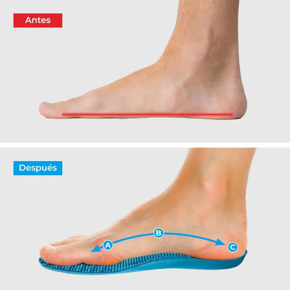 Plantillas ComfyFeet™️ - Disfruta de días sin dolor, sin tratamientos caros ni visitas al médico... - SereniVida Mexico